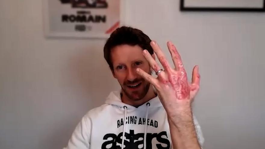 El expiloto de F1 Romain Grosjean muestra sus cicatrices tras sobrevivir al incendio del GP de Bahrein